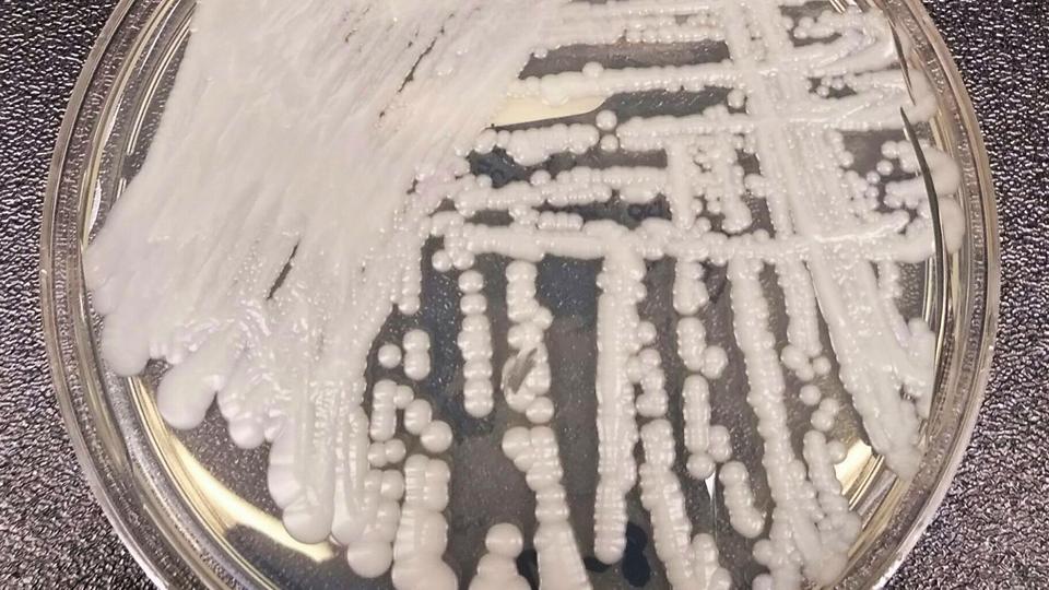 Candida auris is a form of yeast that is usually not harmful to healthy people but can be a deadly risk to fragile hospital and nursing home patients.