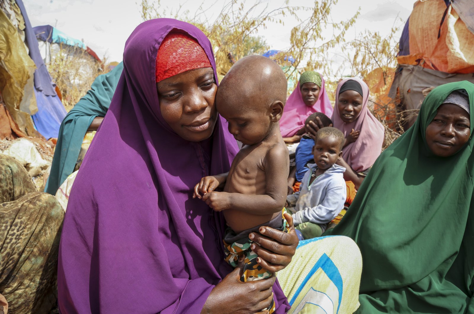 Nunay Mohamed, 25, who fled the drought-stricken Lower Shabelle area, holds her 1-year-old malnourished child at a makeshift camp for the displaced on the outskirts of Mogadishu, Somalia, June 30, 2022. (AP Photo)